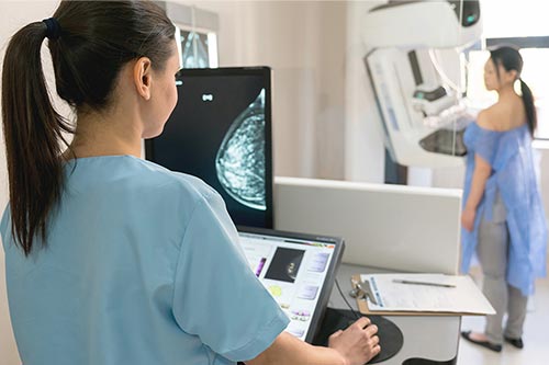 3D MAMMOGRAPHY